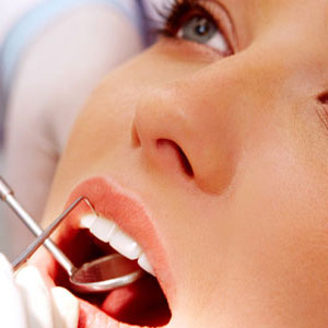 Cosmetic Dentistry Terms and Definitions