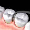 Periodontal Therapy