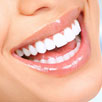 Teeth Whitening