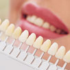 Tooth-Colored Fillings